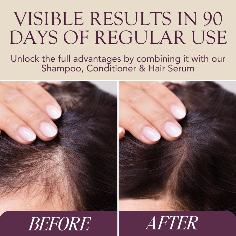 MEGI Wellness Hair Growth Supplement for Women & Men – Biotin, Zinc & Iron Hair Vitamins for Thinning Hair – DHT Blocker with AnaGain™ – Supports Regrowth & Volume – Vegan, 60 Capsules