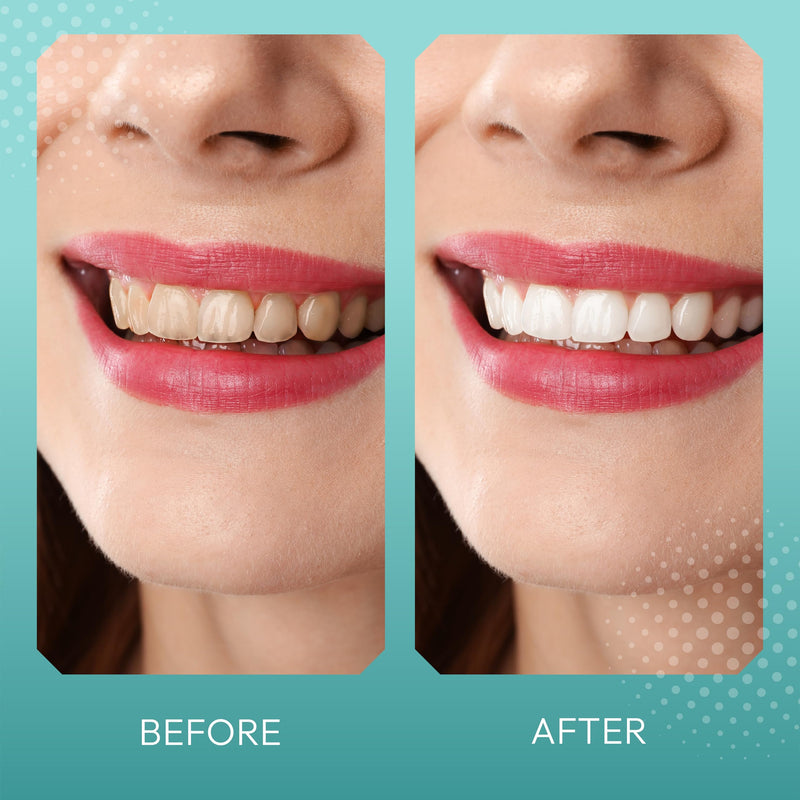 [Australia] - BrightTeal Teeth Whitening Strips - 7 Treatments 14 Total Strips - Enamel Safe, Peroxide Free, Reactive Oxygen Pap+ - Whitening Without The Sensitivity 