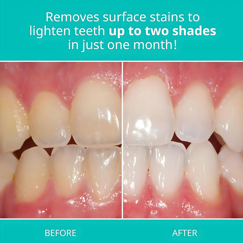 Opalescence Whitening Toothpaste Travel Size 1 Ounce (2 Pack) Fluoride Teeth Whitening Toothpaste, Mint Flavor 402-2 1 Ounce (Pack of 2)