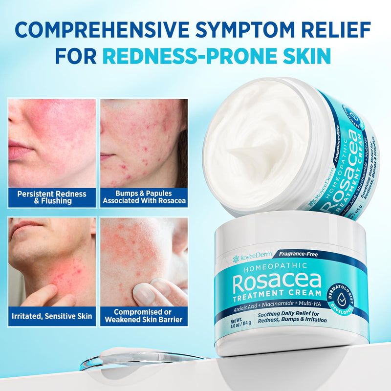 [Australia] - Roycederm Rosacea Treatment for Face with Azelaic Acid ‚Äì Redness Relief & Corrector ‚Äì Sensitive Skin Moisturizer for Redness, Bumps & Irritation with & Sulphur, Niacinamide, Centella & Ceramides 