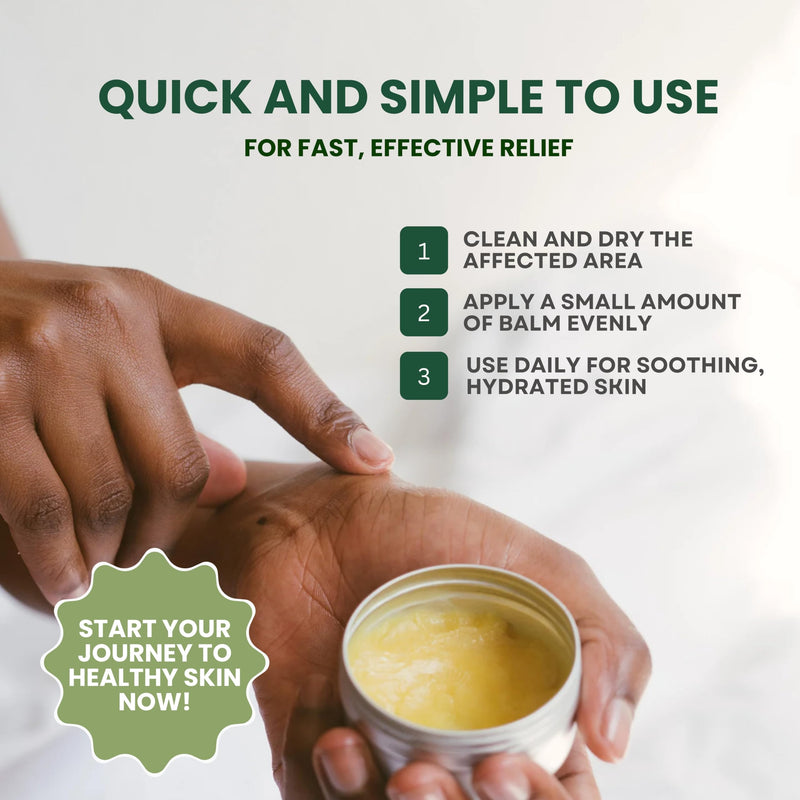 KESMEDIK Tea Tree Oil Balm for Skin, Soothes Itching, Rashes & Dry Skin, Antifungal Defense for Athlete’s Foot, Jock Itch, Chafing, Bug Bites & Eczema, Natural, Effective & Safe for All Ages, 2-Pack 2 Ounce (Pack of 2)