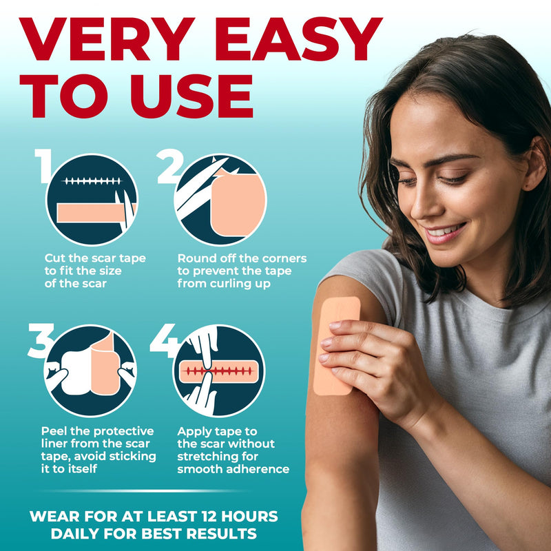 [Australia] - Medical Grade Silicone Scar Tape - 1.6‚Äùx150‚Äù - Visible Difference on Keloid & –°-Section - Reusable Silicone Scar Sheets - Easy to Use Beige 150"x1.6" 