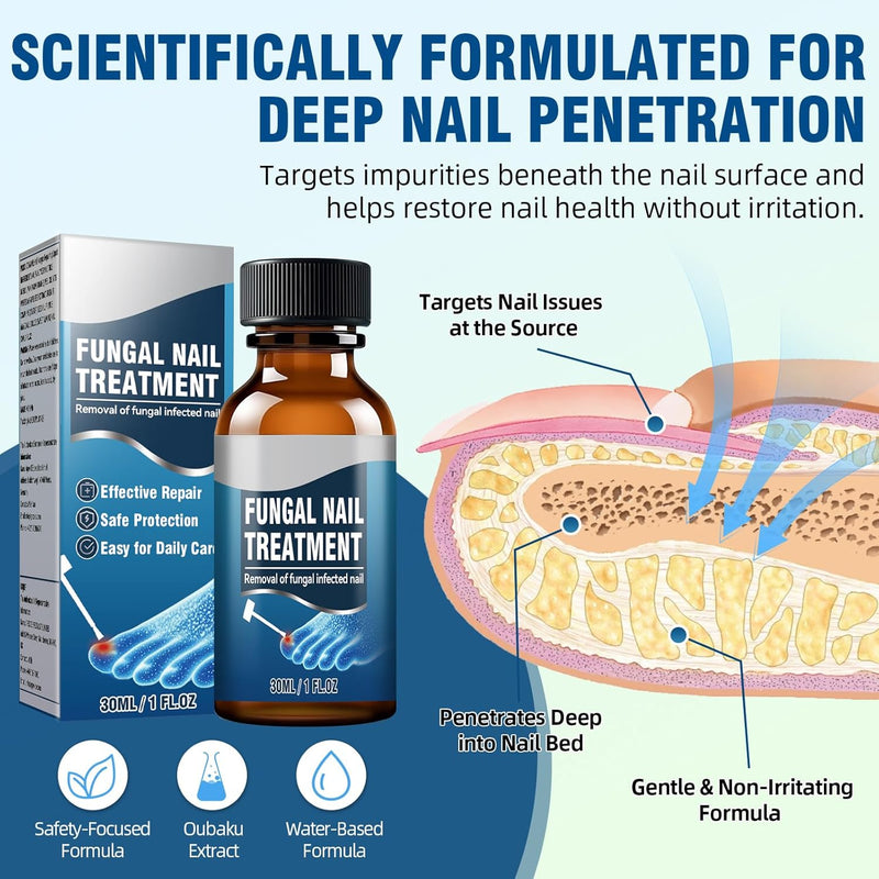 [Australia] - Toenail Fungus Treatment Extra Strength with 25% Undecylenic Acid, Ingrown toenail treatment, nail repair, Fungus nail treatment, yellow toenail, Damaged Nails foot fungus treatment extra strength 2 Fl Oz (Pack of 1) 
