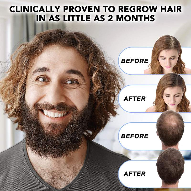 Minoxidil for Men-5% Extra Strength Hair Regrowth for Men Treatment-5% Topical Solution-Dropper Applicator Included -Minoxidil for Women-Stop Thinning & Hair Loss (1)