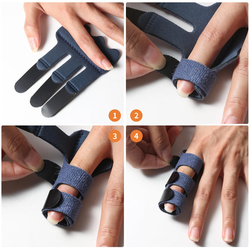 Finger Splint Set – 4 Pcs, Adjustable Trigger Finger Support Brace for Middle Finger Broken Straightening Arthritis Mallet Sprains, Ideal for Pain Management