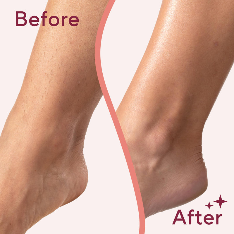 [Australia] - Finishing Touch Flawless Legs, Electric Razor for Women, Pivoting Head Leg Hair Remover with LED Light for Instant and Painless Leg Hair Removal New Version 
