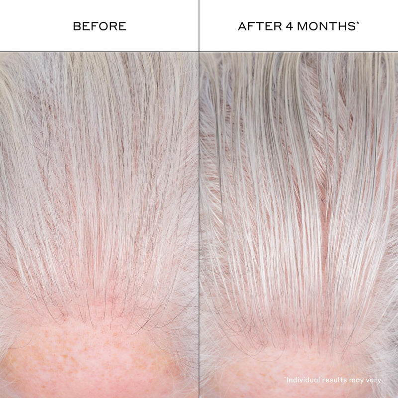 Zenagen Densifying Hair Serum | Boosts Hair Density 1.7 Fl Oz (Pack of 1)