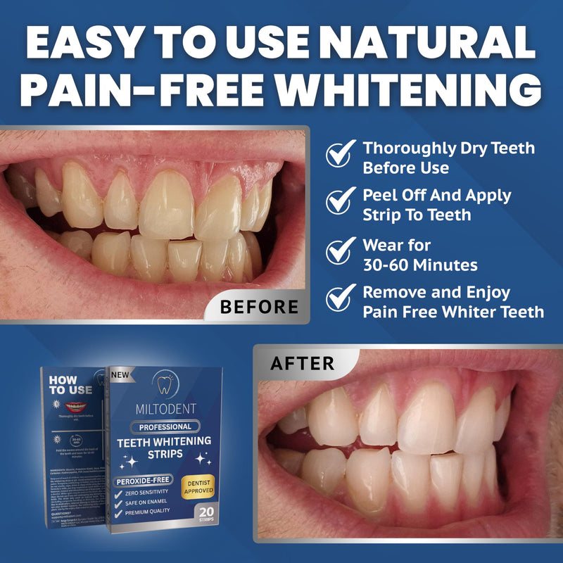[Australia] - MILTODENT Teeth Whitening Strips | Dentist Formulated | Peroxide Free Whitening Strips for Sensitive Teeth | Enamel Safe | Mint, Coconut (20 Count) 20 Count (Pack of 1) 