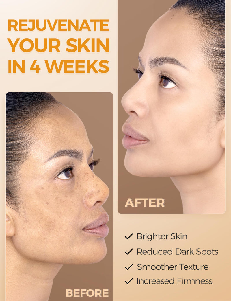 NING DERMOLOGIE Vitamin C Serum with Niacinamide & Ethyl Ascorbic Acid | Brightening, Moisturizing Face Serum for Dark Spot | Hyperpigmentation & Anti-Aging Treatment | Korean Synergy Formula 1.01oz