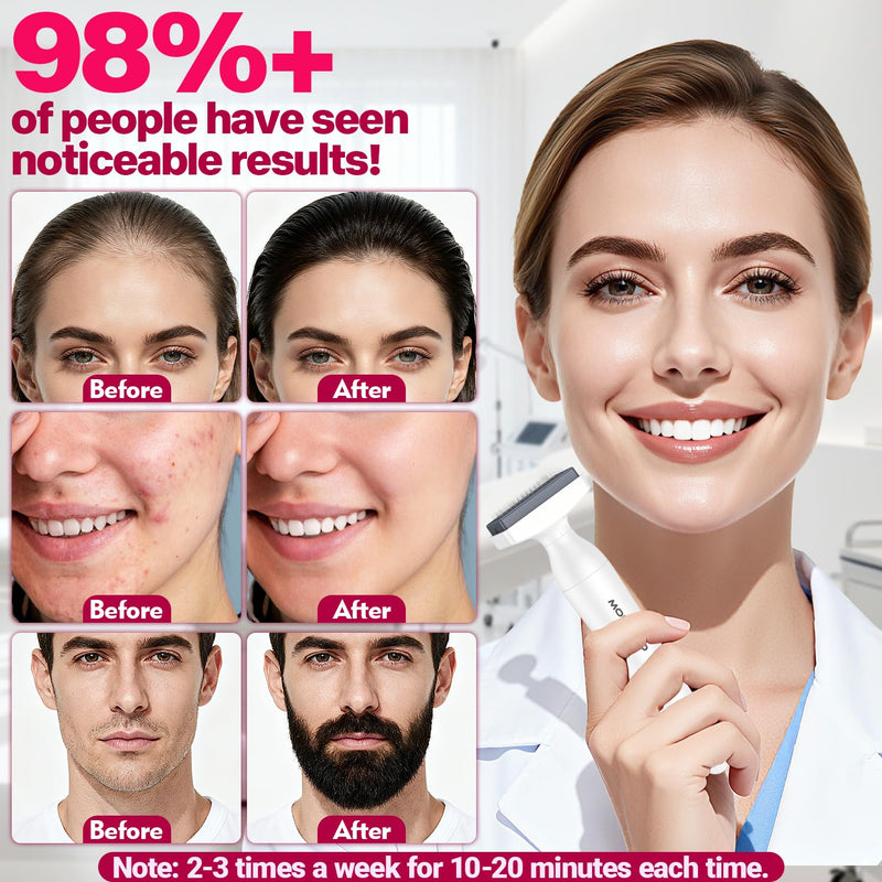 [Australia] - Derma Stamp, MONESAO Microneedling Stamp for Skin Face Hair Scalp Beard, Microneedle Dermastamp Tool with 2 Replacement Heads, Micro Needling Stamp Kit for Women and Men 