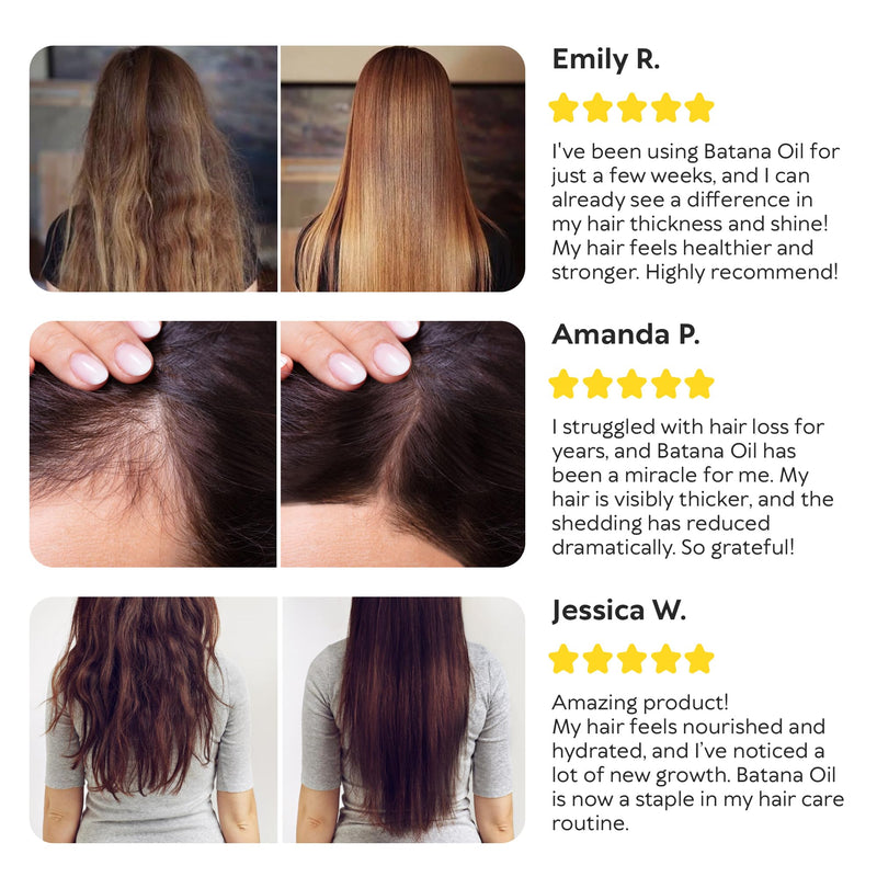 Batana Oil for Hair Growth - 100% Raw & Organic Unrefined Batana Oil - Cold Pressed Hair Mask for Scalp Health, Thicker Hair & Split Ends Repair - Natural & Pure (4.23 oz) 4.23 Fl Oz