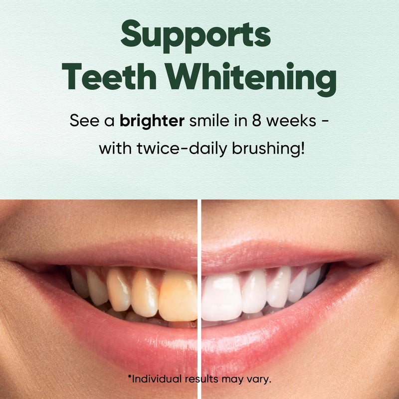 [Australia] - MySmile Fluoride Free Toothpaste, Nano Hydroxyapatite Toothpaste for Sensitive Teeth, Strengthens Enamel, Remineralizes & Whitens Teeth, Freshens Breath for Adults, SLS Free, Natural Misty Mint, 4.2oz 4.2 Ounce (Pack of 1) 