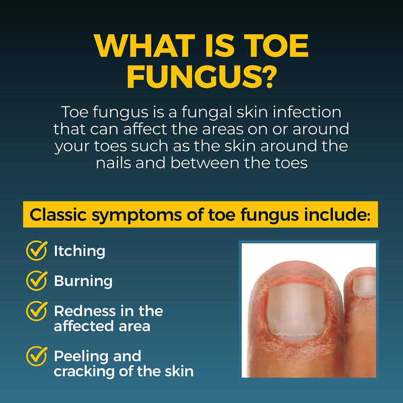 Fungi-Nail Pen Apllicator Anti-Fungal Solution 0.101 Fl Oz 0.1 Fl Oz (Pack of 1)