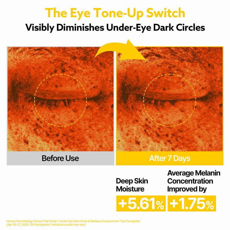 signiq VITA Brightening Eye Cream | Vitamin C | Hydrating Eye Care for Radiant Looking Skin | Korean Skincare, 1.01 fl.oz. Yellow