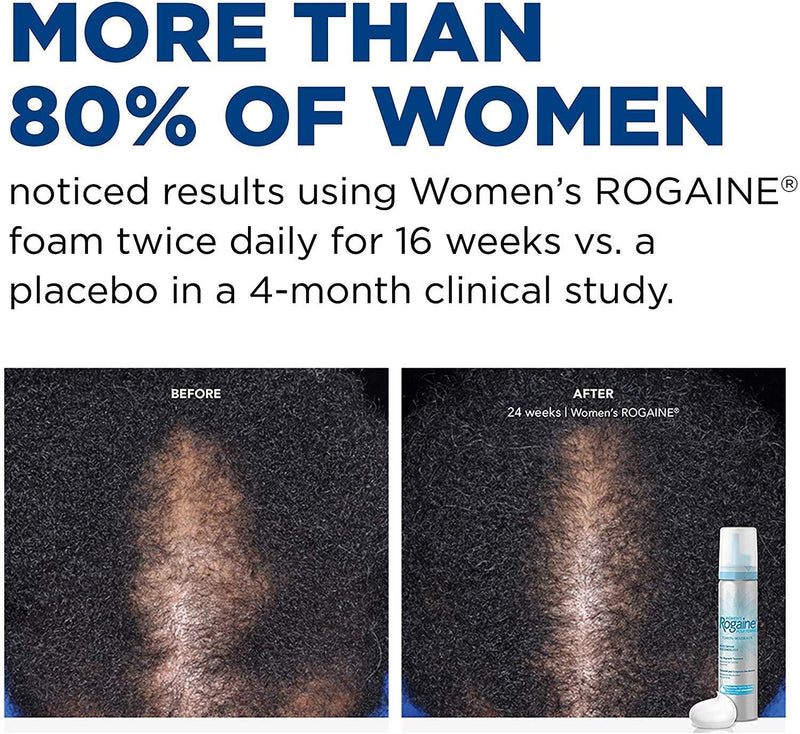 Women's Rogaine 5% Minoxidil Foam, 2-Month Supply, 2.11 oz 2.11 Ounce (Pack of 1)