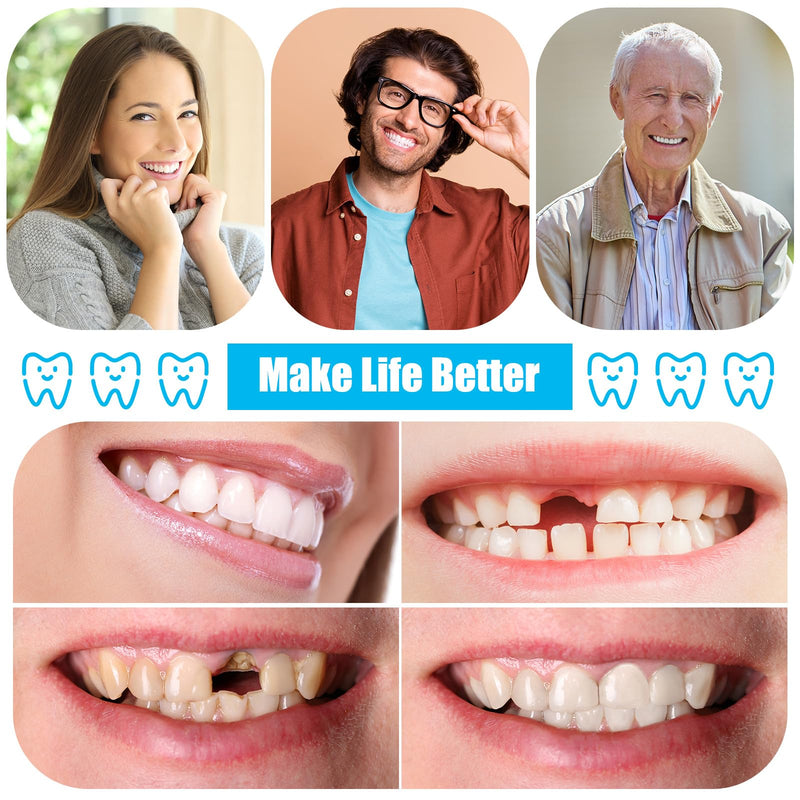 [Australia] - 16 Pcs Dentures DIY Repair Kit Fake Teeth Kit Make Your Own Dentures Kit Repair Missing Teeth Easy and Convenient Customizable Denture Solution for Improve Smile 