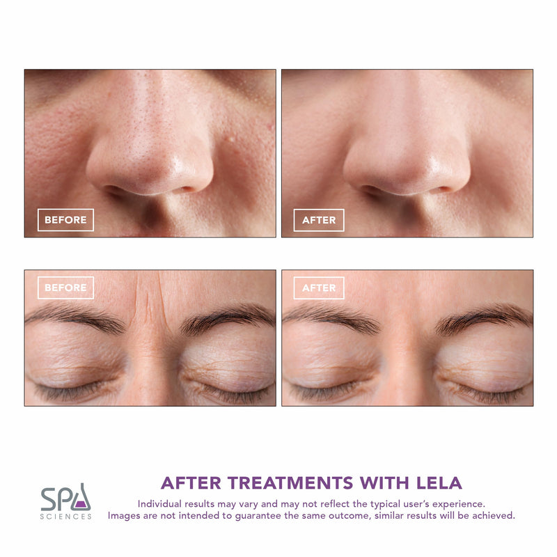 Spa Sciences - LELA - 4-in-1 Facial Spatula for Deep Cleansing, Pore Extraction, Serum Infusion, Anti-Aging and Contouring