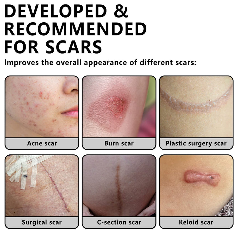[Australia] - Silicone Scar Sheets, Silicone Scar Tape, Transparent 1.6”X 60”,Silicone Tape For Scars,Scar Sheets For Surgical Scars,For C-Section, Tummy Tuck, Acne Scar Treatment, Keloid Scar Remova 