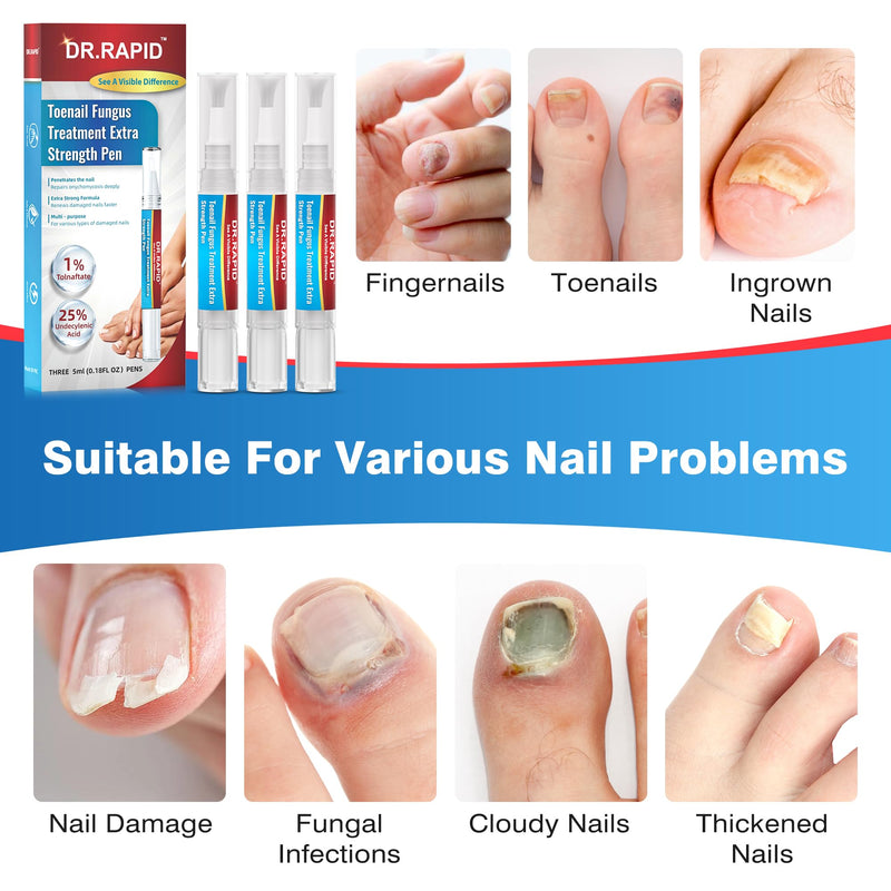 [Australia] - Toenail Fungi Treatment Extra Strength - Fungi Nail Pen Antifungal Repair for Damaged Nails, Fast-Acting Solution for Toe & Fingernail Fungi, Ideal for Nail Health Concerns Athletes 5ml/0.18FLOZ 3Pcs 1 Count (Pack of 3) 