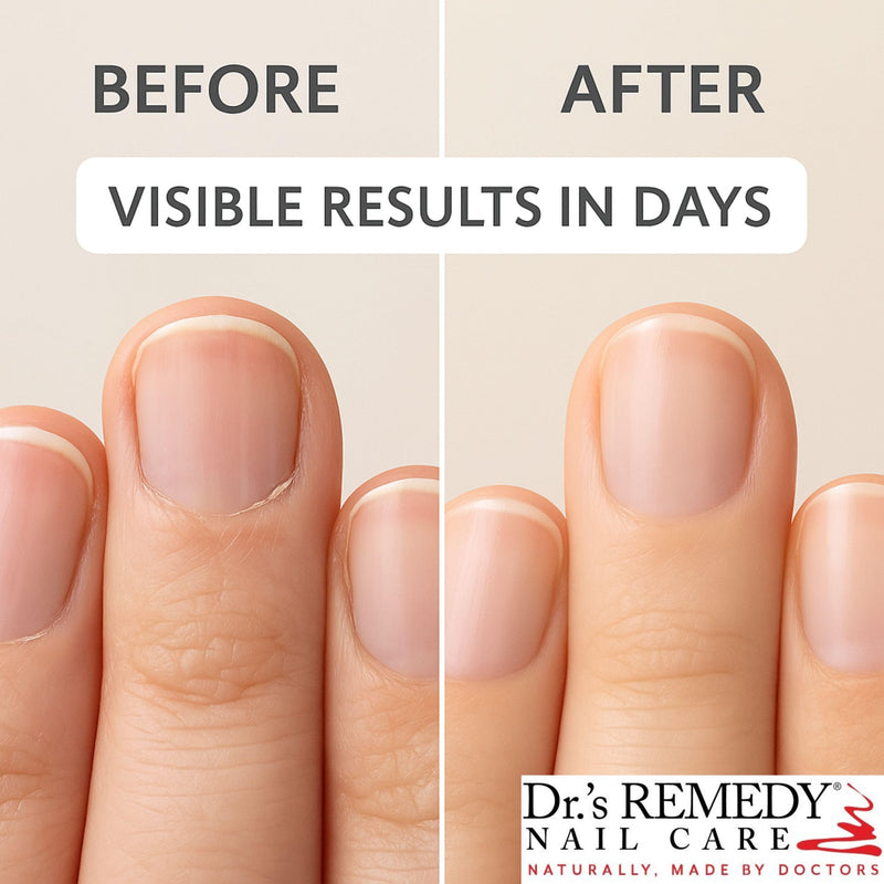 Dr.'s Remedy Therapeutic Caress Cuticle Oil, Nourishing Treatment for All Nail Types, 0.507 Fl Oz (Pack of 1)