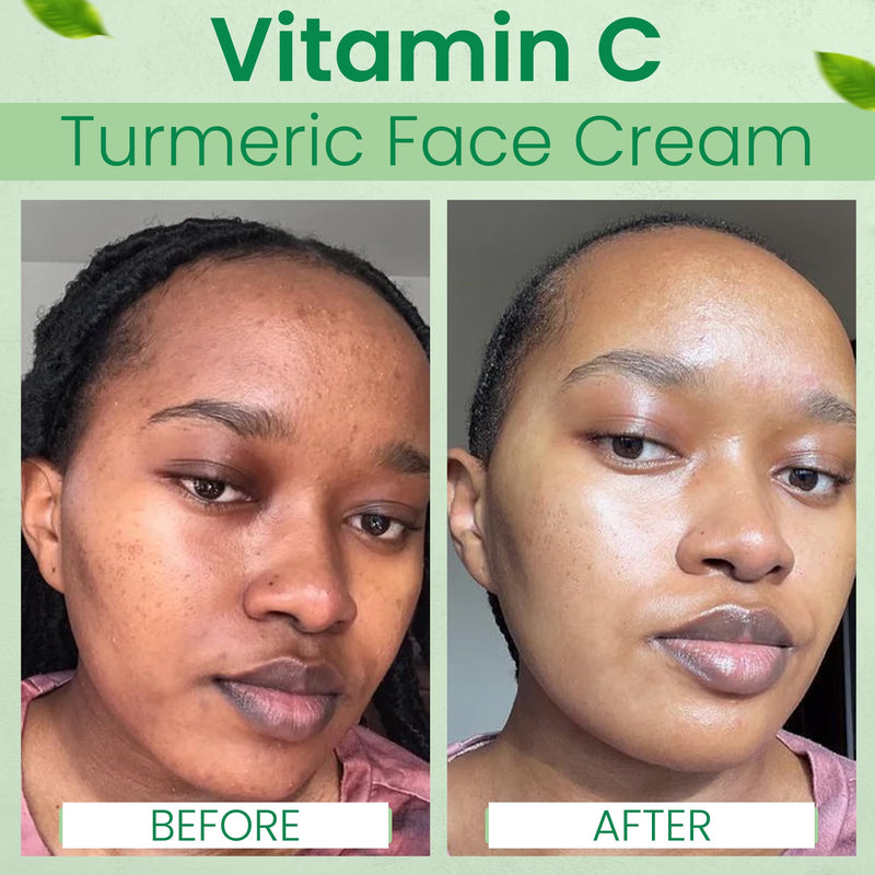 Lightweight Vitamin C Turmeric Face Cream – Daily Hydration Moisturizer, Fast Absorbing, Non-Greasy Feel – 1.76 fl oz