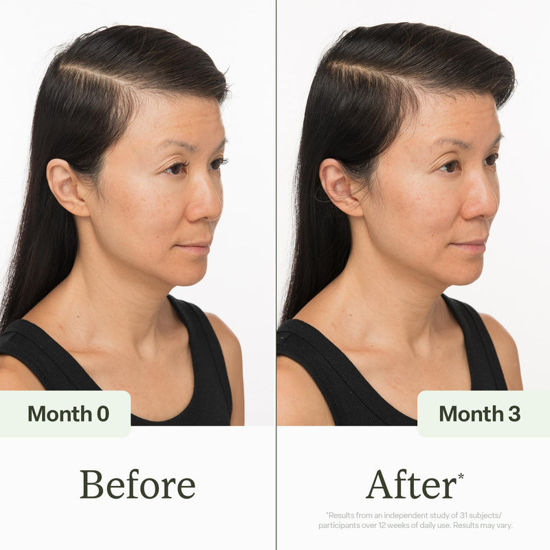 Divi Scalp Serum | To Promote Fuller-Looking Hair with Peptides | 30ml | Multi-Peptide Complex, Caffeine, Rosemary Oil, Vegan, Non-Greasy, Thinning Hair, Fuller-Looking Hair, Scalp Serum, 30ml 30 ml - 1 Month Supply