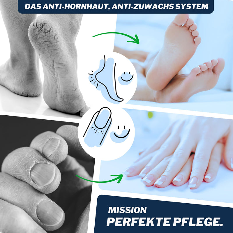 [Australia] - Mr. Fuss Starter Kit - 5 pieces, callus remover system package 