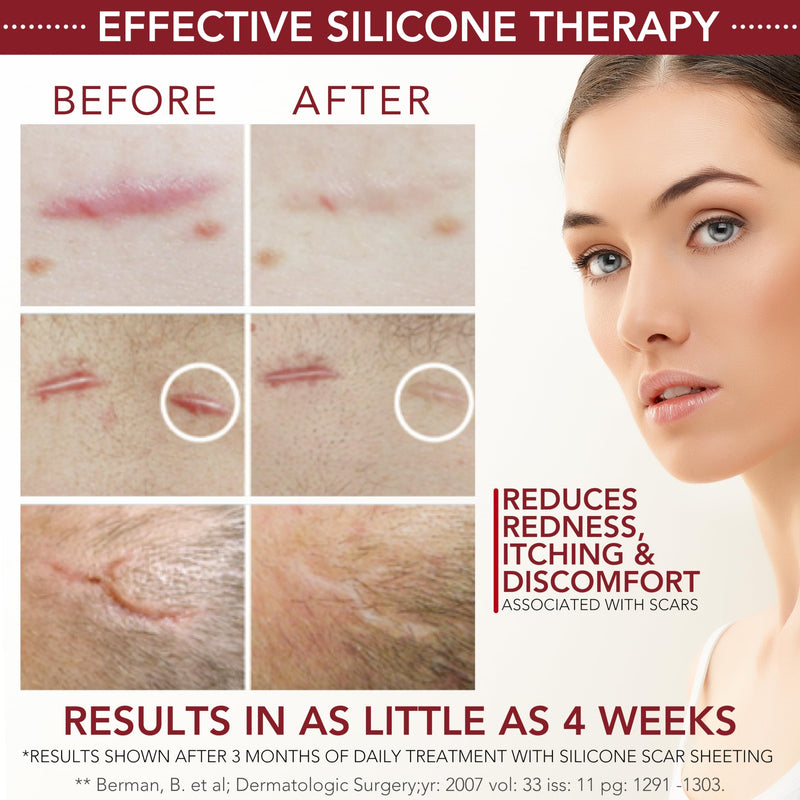 [Australia] - Physician Formulated Silicone Scar Gel Semi-Solid Sheeting - Advanced Crosspolymer Medical Grade Liquid Sheeting for Face, Body, Surgery, C Section, Burn, Keloidal & Hypertrophic Scars 