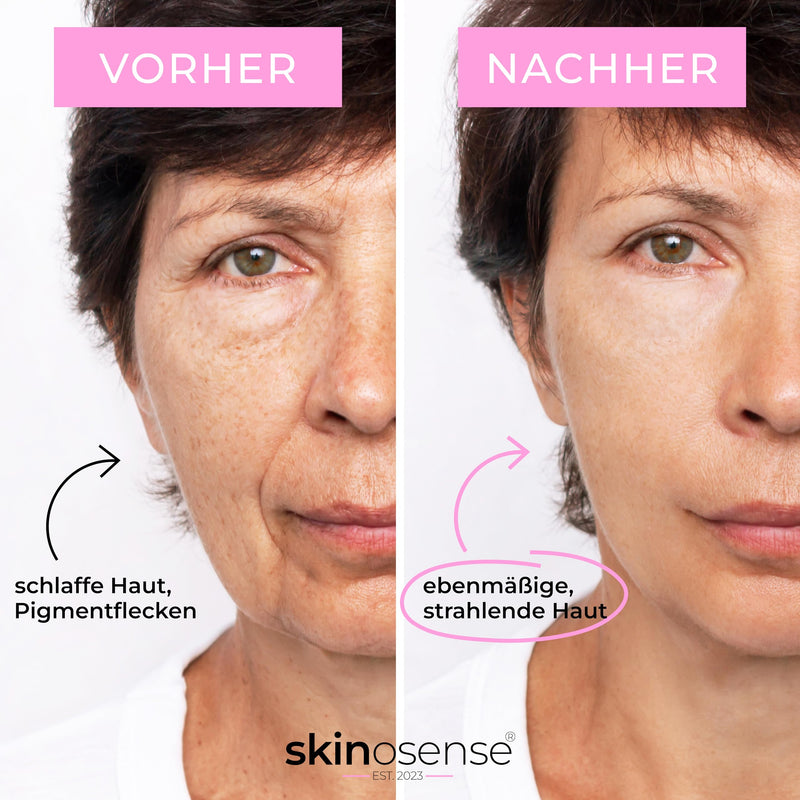Vitamin C Booster Serum Face - Anti-Ageing Glow Care with Antioxidants | Vegan Moisturising Serum for a Radiant Complexion - 30 ml