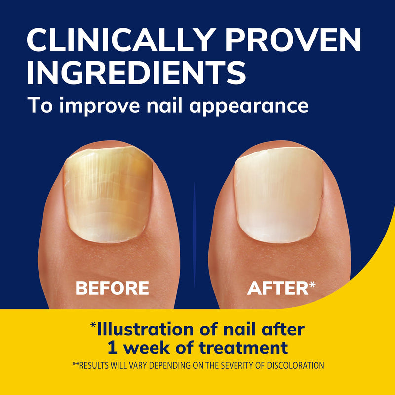 Dr. Scholl's Fungal Nail Revitalizer Liquid, 10ml