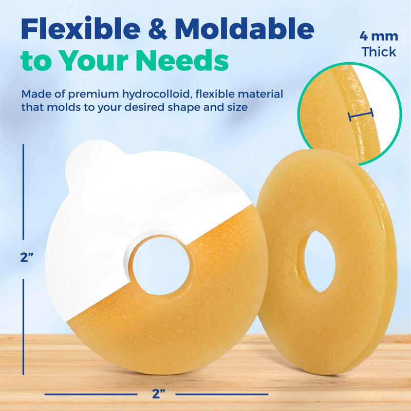 [Australia] - NuBliss Moldable Ostomy Barrier Ring ‚Äì 10-Pack, 4mm Thick ‚Äì Leak-Free Hydrocolloid Skin Adhesive Ostomy Supplies ‚Äì Flexible Stoma Protector Seal for Colostomy & Ileostomy Bags Standard Adhesive 