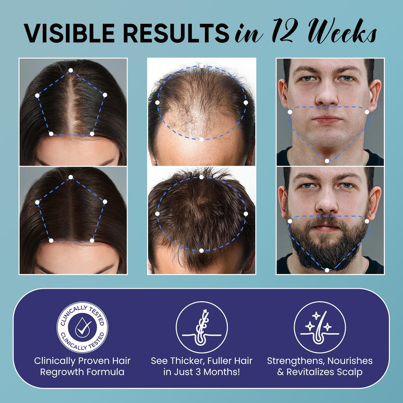 5% Minoxidil for Men and Women Hair Growth Kit: Minoxidil Spray Hair Regrowth Treatment Serum with Biotin & Rosemary -Stop Hair Thinning and Hair Loss For Stronger Thicker Longer Hair 2 Pack