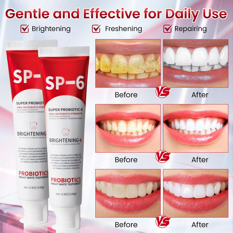 [Australia] - SP-6 Probiotic Whitening Toothpaste, SP-6 Probiotic Toothpaste, Enhanced Formula with 6 Probiotics for Teeth Whitening/Brightening, Enamel-Safe, Fluoride-Free, Fresh Mint Flavor, 4.9oz, 2Pack 2 