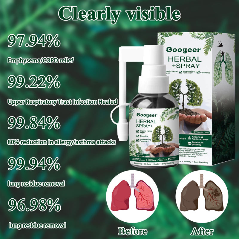 [Australia] - 3 Pcs Lung Cleansing Respinature Herbal Spray Cleansing Lung Lung Spray Respi Nature Herbal Spray Herbal Lung Cleansing Spray Herbal Lung Cleanse Lungwort Lungwort Nasal Spray 