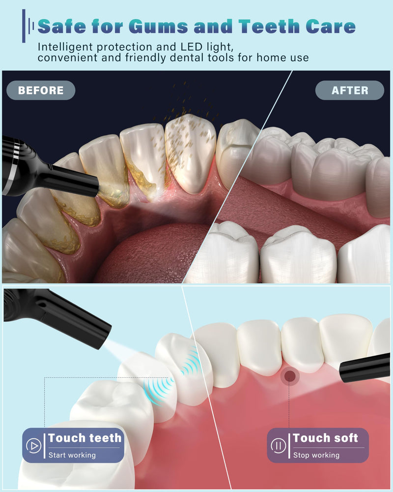 [Australia] - Teeth cleaning set, Stim-U-Dent tartar removal for humans with 5 modes for humans and dogs, stain removal, for domestic removal of tartar at home, rechargeable ebony 