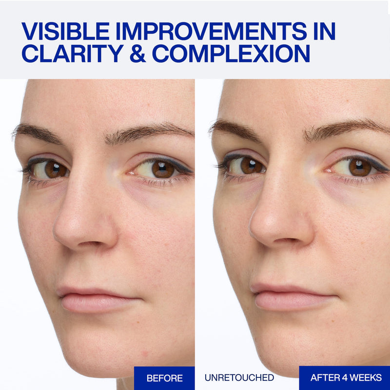 IOPE Expert Vitamin C 25% Antioxidant Serum - 25% Pure Vitamin C Face Serum - Visibly Evens Skin Tone, Enhances Radiance, and Smooths Texture – 5 Antioxidants and PHA - 0.77 fl. oz.