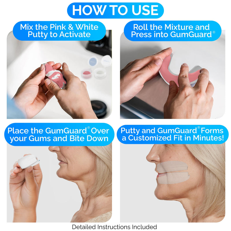 [Australia] - GumGuard Denture Mouthguard Soft, Customizable Fit for Upper & Lower Arches, Relief for Grinding & Clenching - Ideal for Denture Wearers & Implant Patients Ultrasoft Upper White Guard 1 UltraSoft Upper Arch 