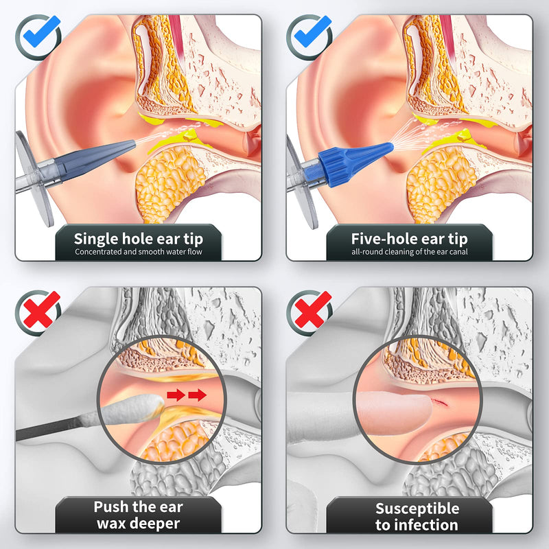 [Australia] - Ear Wax Removal, Ear Cleaner, Ear wax Removal Kit, Manual Ear Irrigation Flushing System, Ear Cleaning Kit, Safe and Effective to Clean Ear Built Up Wax Green 