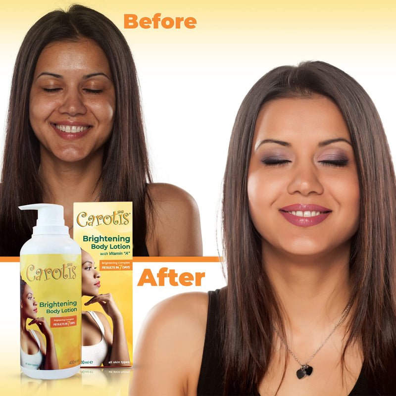 CAROTÏS, Skin Brightening Lotion - 13.5 Fl oz / 400ml |For Body, Knees, Elbows, Hands, with Carrot Oil and Vitamin A
