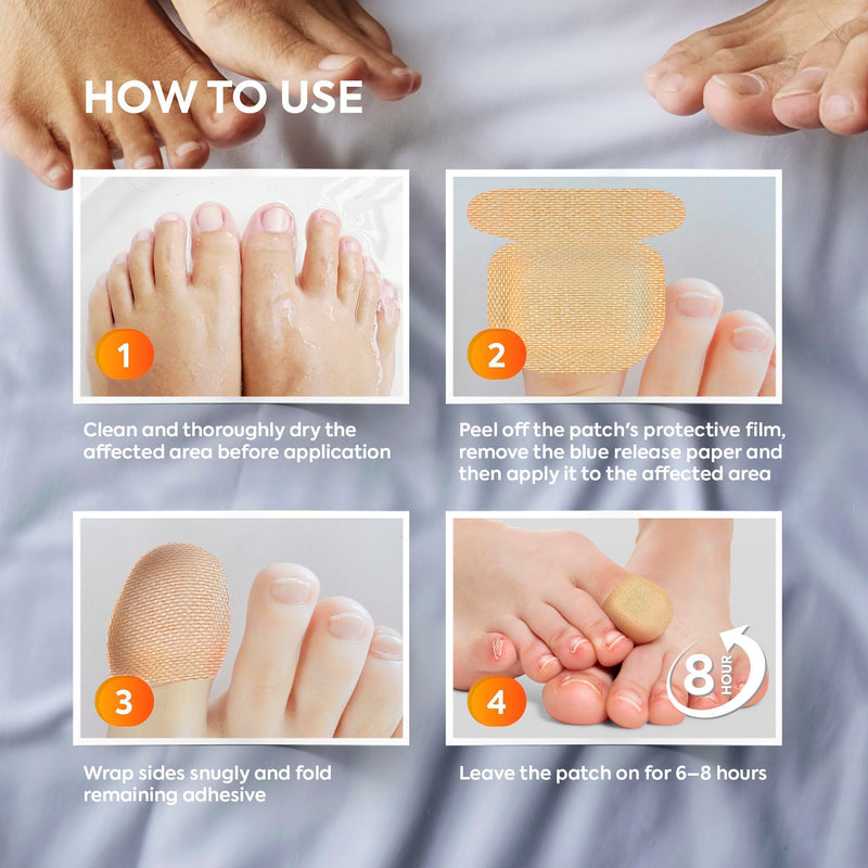 Toenail Fungus Treatment Extra Strength: Nail Fungus Treatment Patches for Toenail and Fingernails - 8-Hour Nighttime Renewal with 1% Tolnaftate - 32 Patches