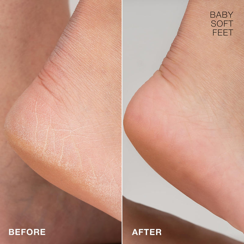 [Australia] - STARSKIN Magic Hour, Exfoliating Foot Mask Sock with Lactic and Glycolic Acid, Gently Removes Calluses and Dead Skin for Effective Peeling, K Beauty Skincare (4 Pack) 