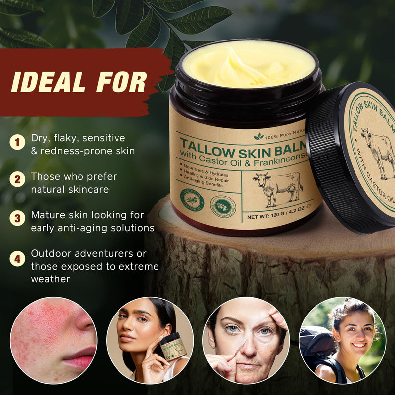 2 Pcak Beef Tallow Cream with Castor Oil and Frankincense, 100% Grass-Fed Tallow for Skin Care, Face & Body Moisturizer for Skin, Sensitive Skin & Dry Skin Age Defying, Eczema All-Purpose Balm Beef Tallow with Frankincense 2 Pack