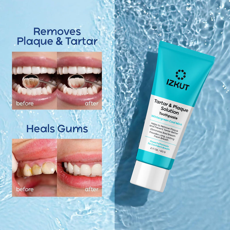 Plaque & Tartar Remover Toothpaste for Teeth: Removes Plaque & Controls Tartar Build-up - Long-Lasting Fresh Breath, Deep Cleansing & Gum-Friendly Formula (Wintergreen) Wintergreen