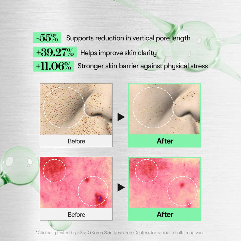 VT COSMETICS Reedle Shot 100 & PDRN Essence Set, Microneedling Serum and Glow Serum Duo for Glass Skin, Korean Skincare, Gift Set, Mother's Day