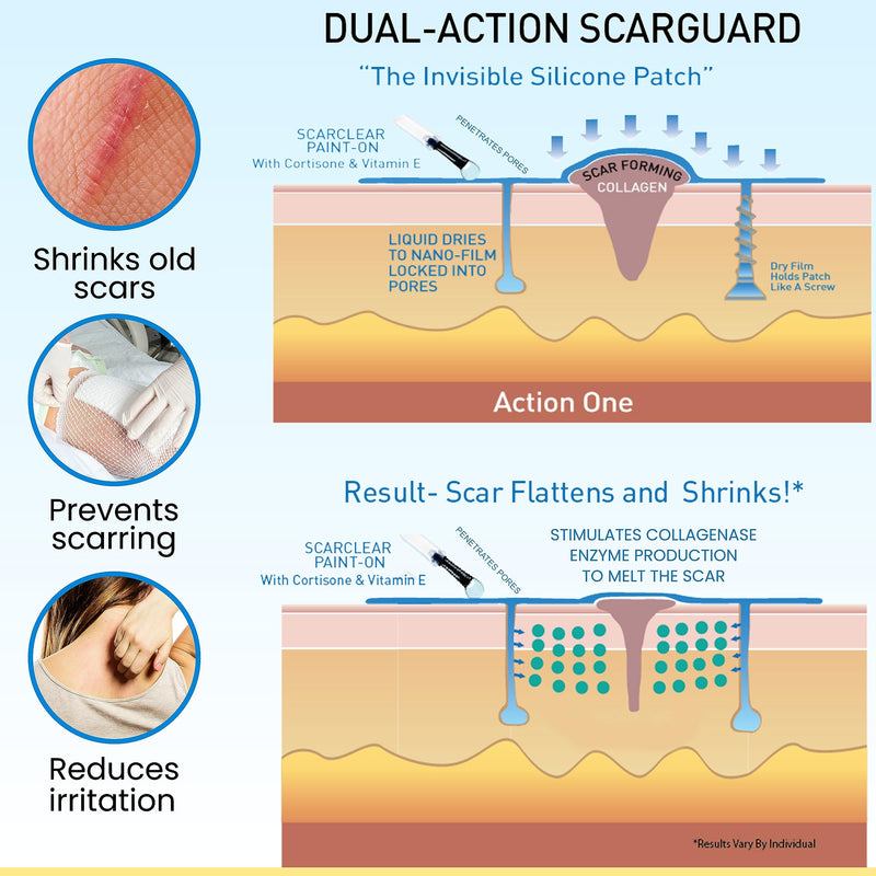 [Australia] - Invisible Brush-On Silicone Sheet with Vitamin E - Scar Removal for Keloids, Burn Scars, Surgery Scars, Stitches, Cuts - No Ugly Scar Sheets, Cream or Messy Scar Gel Needed 