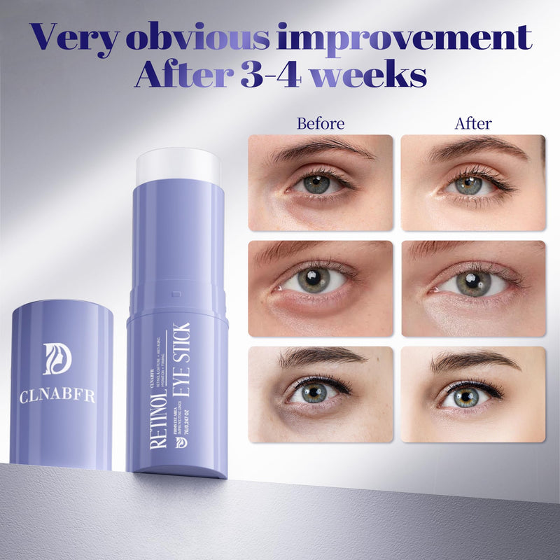 [Australia] - Retinol Eye Stick, Under Eye Balm for Dark Circles and Puffiness, Anti Aging Caffeine Cream Reduces Fine Lines, Wrinkles Moisturizer Stick (0.24oz/7g) 