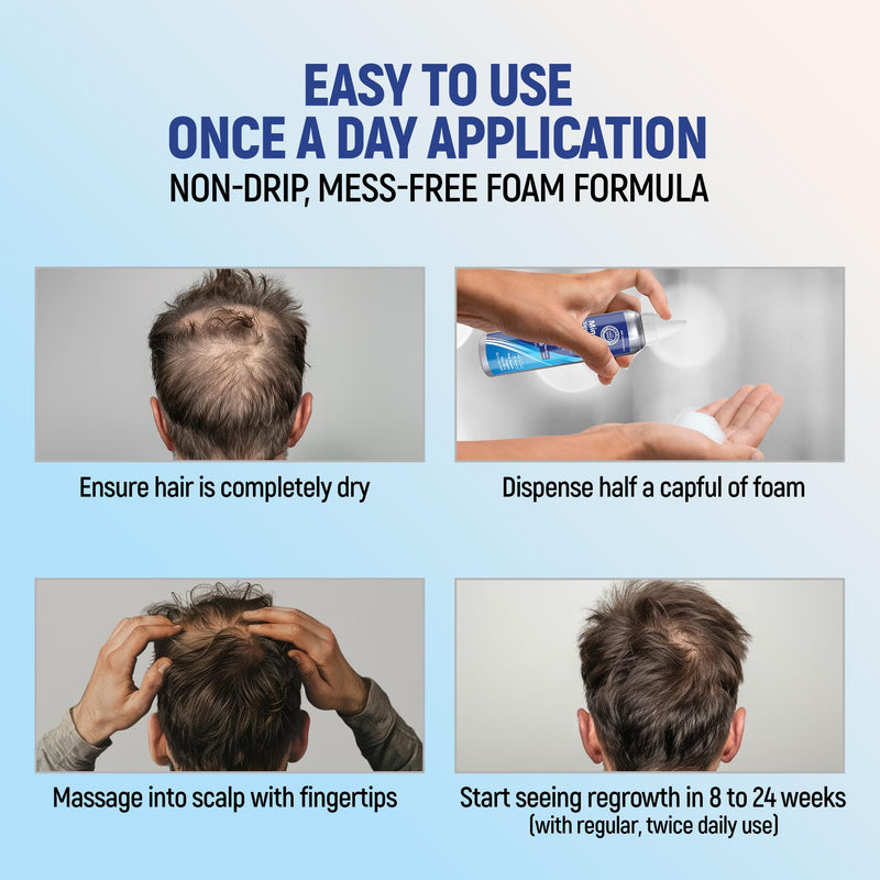 Minoxidil 5% Topical Aerosol Foam, Hair Regrowth 4 Months Treatment for Men, 2.11 oz (4 Pack) 2.11 Ounce (Pack of 4)