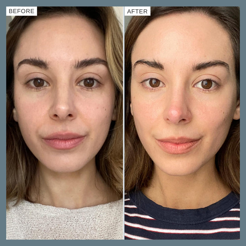 Alpha-H Face Serum - Daily Brightening For Dull, Uneven Complexion - Helps Boost Glow And Smooth Texture - Lightweight Comfort For Dry, Sensitive Skin Vitamin C: Clarity