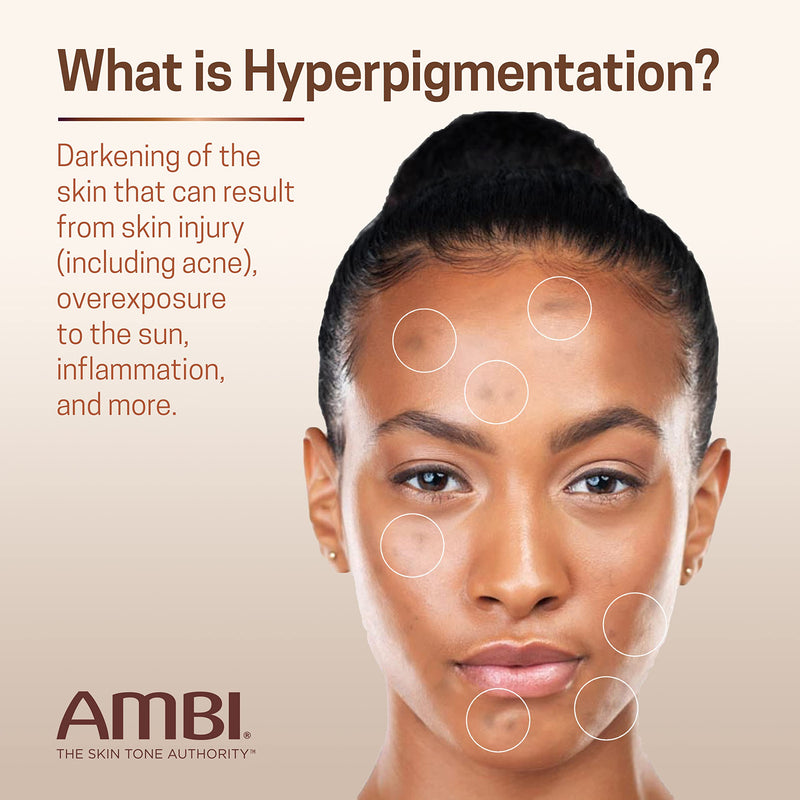 Ambi Even & Clear Fade Cream, Hydroquinone-free, Hyperpigmentation Treatment, Dark Spot Corrector, Results In As Little As 4 Weeks, Niacinamide, Aloe Vera, Vitamin C, 1 Fl Oz 1 Fl Oz (Pack of 1)