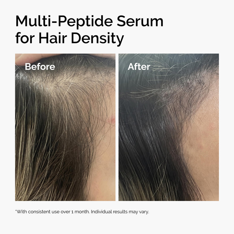 The Ordinary Multi-Peptide Serum for Hair Density, Peptide-Powered Formula for Thicker, Fuller Looking Hair 2.02 Fl Oz (Pack of 1)